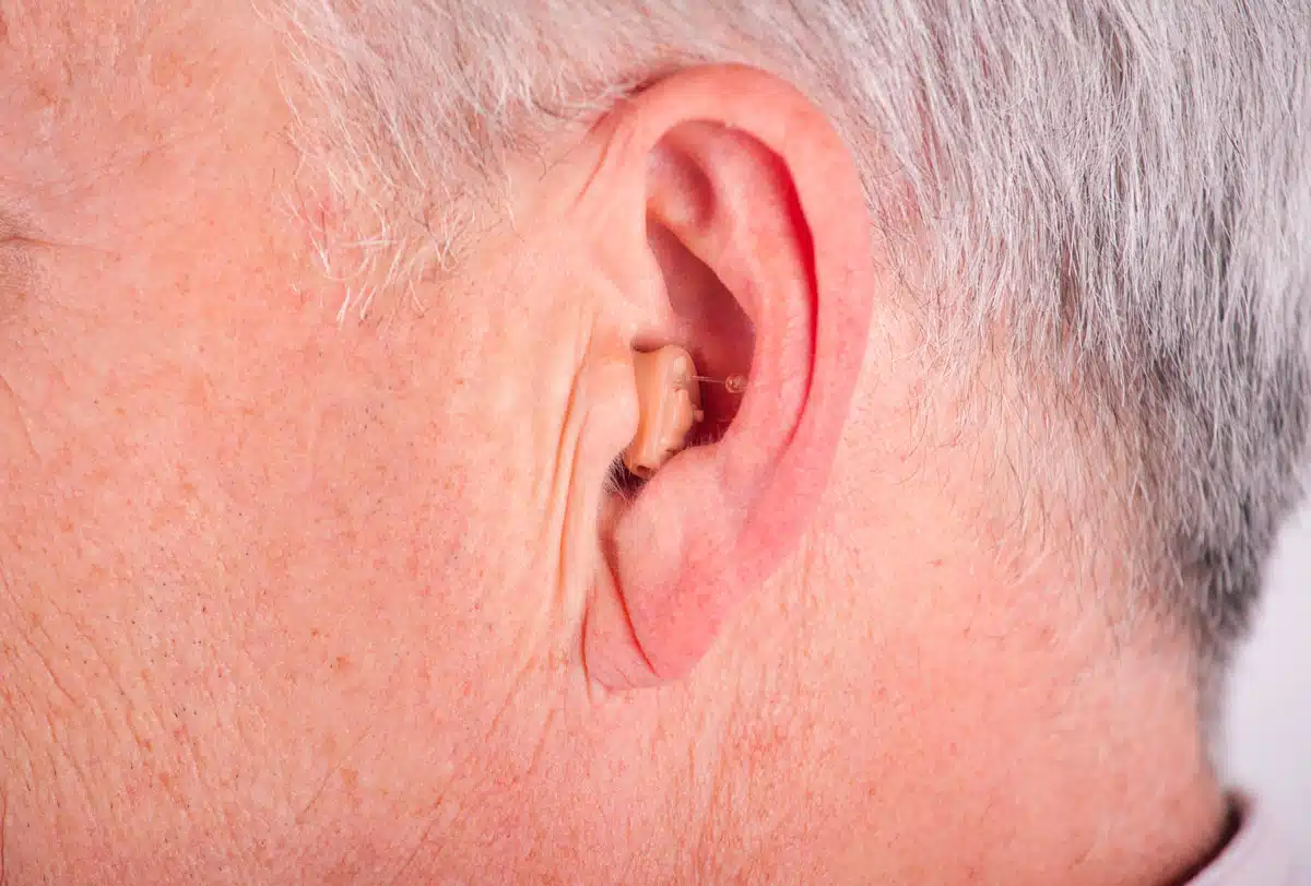 Apparecchi Acustici