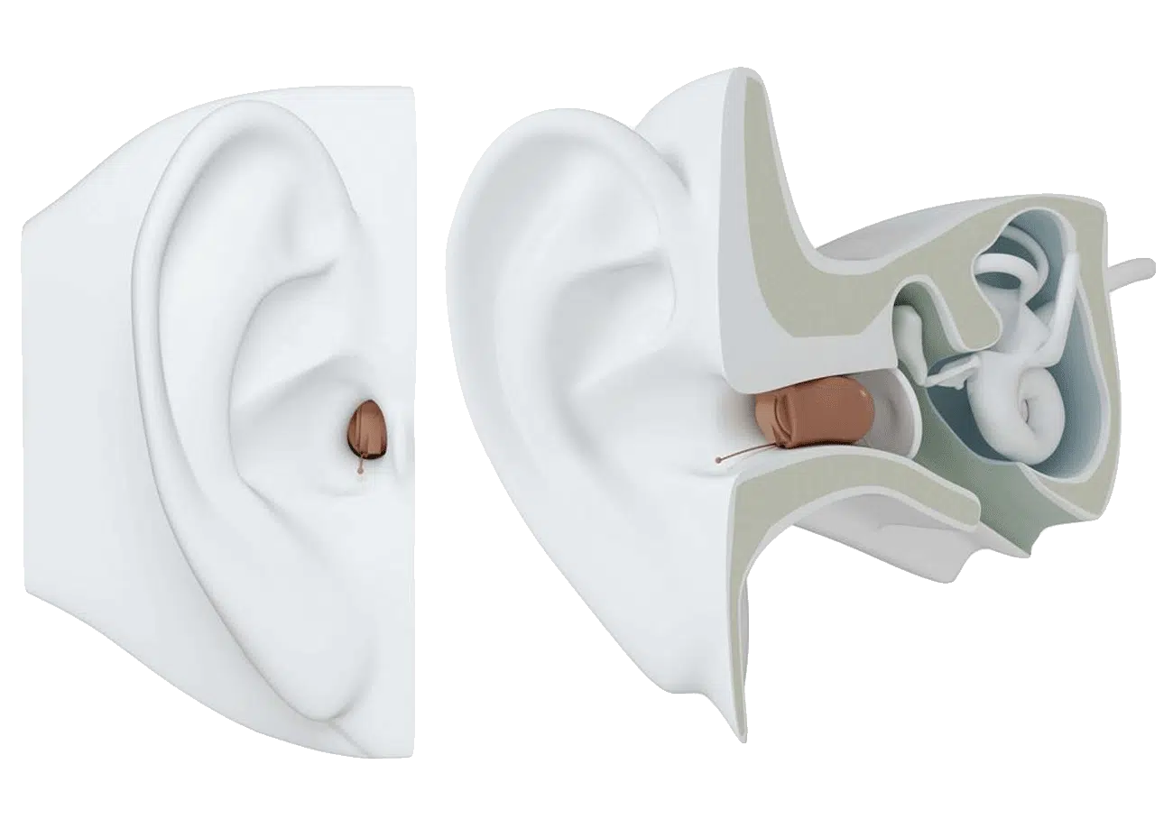 Apparecchi Acustici - 5