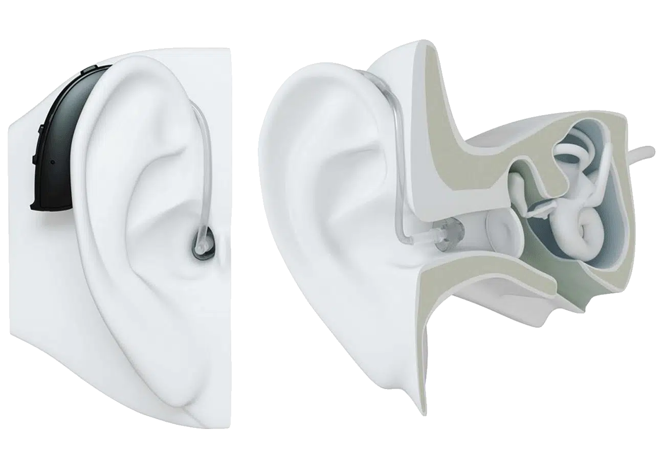 Apparecchi Acustici - 19